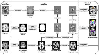 The impact of iron deposition on the fear circuit of the brain in patients with Parkinson’s disease and anxiety